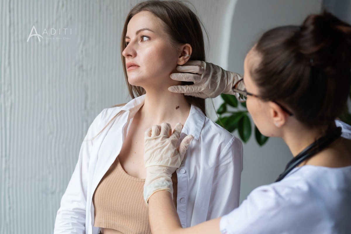 Skin Tag Removal